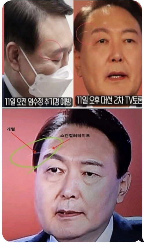 네티즌들이 공개한 사진에는 실제로 전에는 없었던 흰 눈썹 하나가 보이고 거기에 살 색깔 테이프가 희미하게 붙어 잇는 것이 보인다./©️인터넷캡쳐